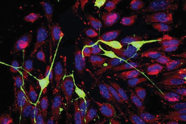 Zlodejstvá rakovinových buniek