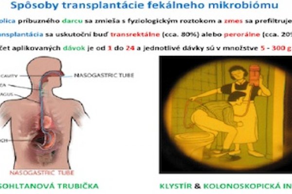 Fekálie príbuzných vám môžu zachrániť život - II.časť